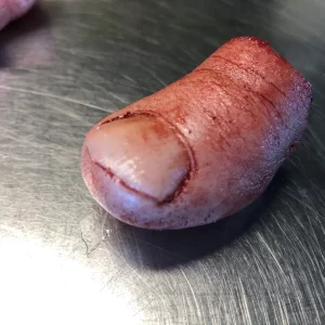 Severed Big Toe