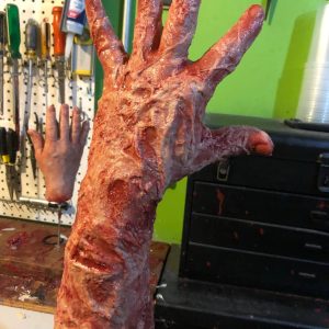 Burned Victim Arm