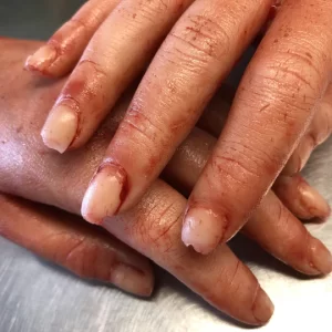 Severed Female Hands