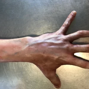 Severed Male Arm with Fingers Spread