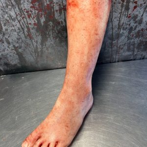 Severed Leg